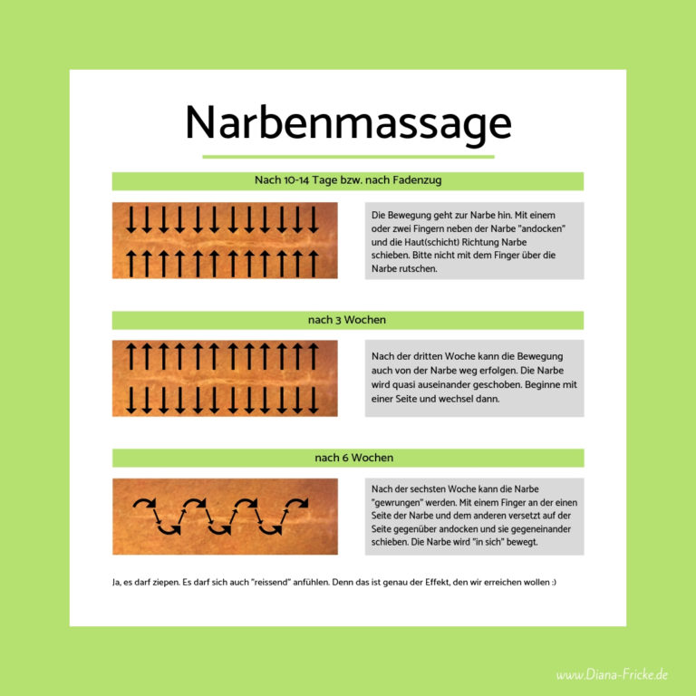 Behandlung bzw Massage einer Narbe um Verklebungen und Bewegungseinschränkungen zu lösen